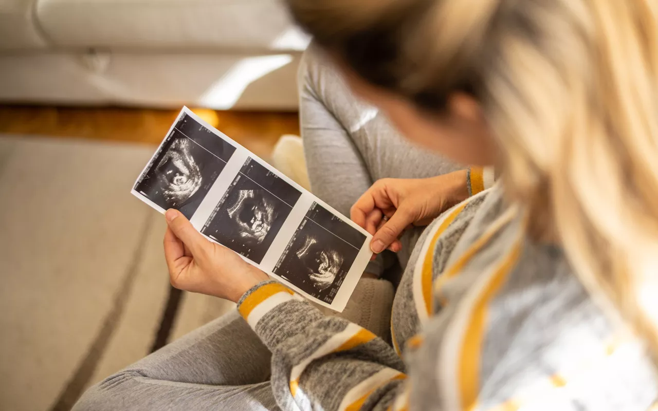 Ensimmäisestä ultrakuvasta voi yrittää selvittää vauvan sukupuolen nub-teorian avulla.