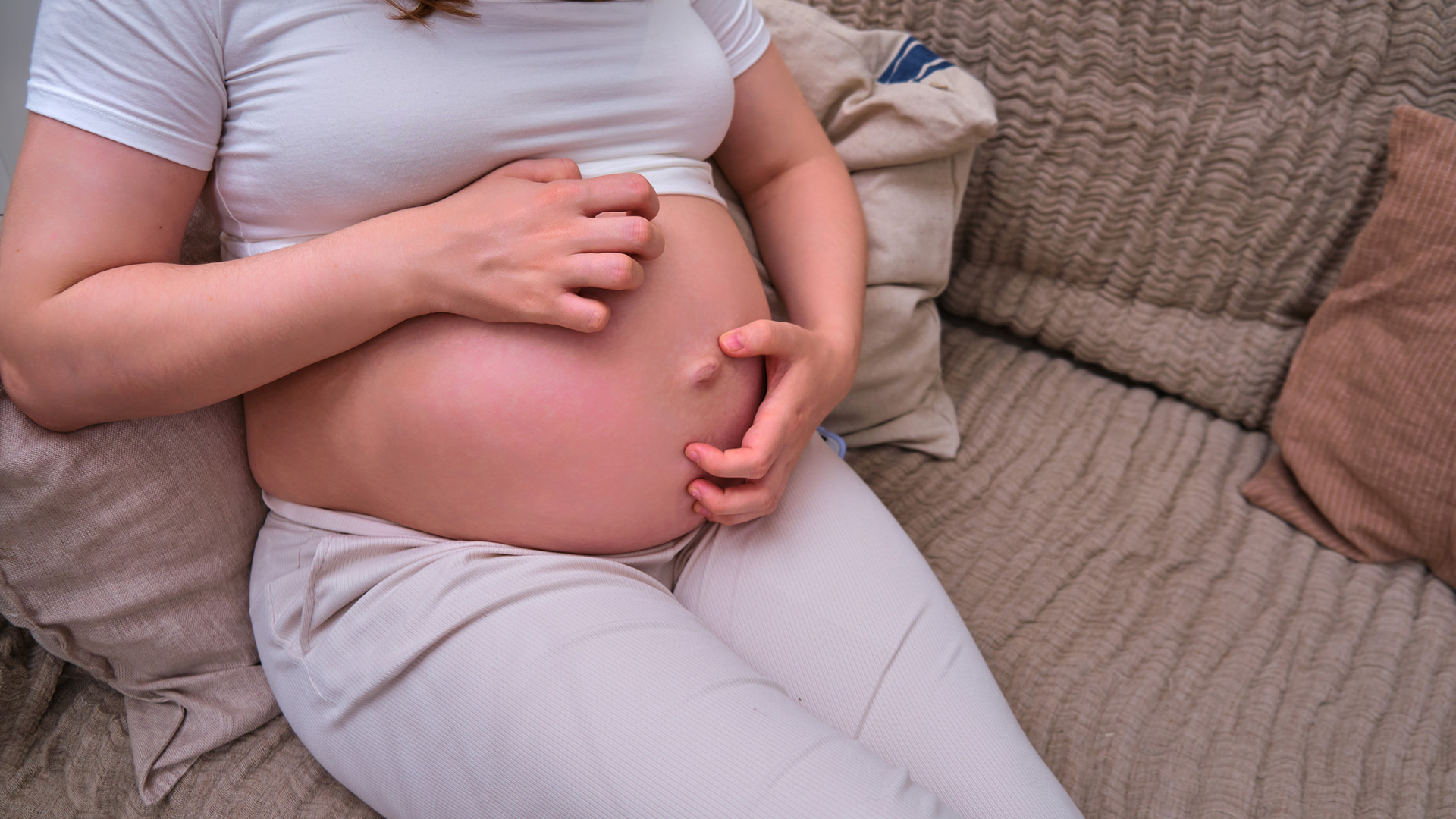 monimuotoinen raskausihottuma: raskaana oleva nainen raapii vatsaansa