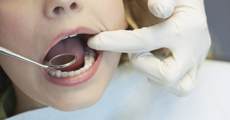 hammaslääkäripelko: lapsen suu hammaslääkärissä